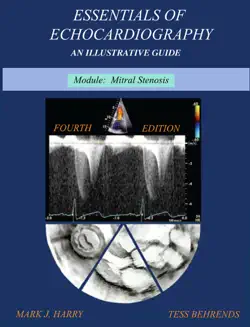essentials of echocardiography module mitral stenosis book cover image