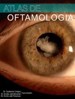 atlas de oftamología book cover image