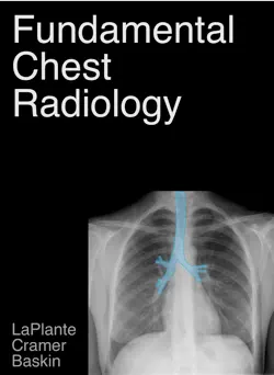 fundamental chest radiology book cover image