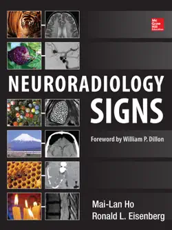 neuroradiology signs book cover image