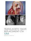 Trans-Aortic Valve Replacement CTA synopsis, comments