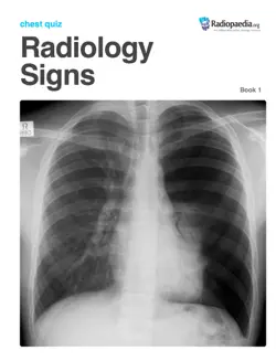radiology signs chest quiz - book 1 book cover image