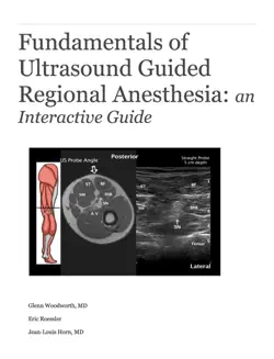 fundamentals of ultrasound guided regional anesthesia: an interactive guide book cover image
