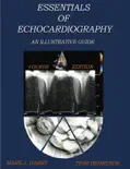 Essentials Of Echocardiography: An Illustrative Guide book summary, reviews and download