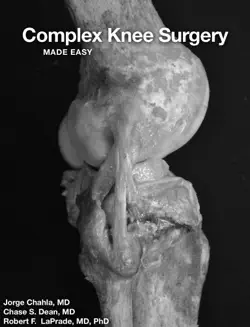 complex knee surgery imagen de la portada del libro