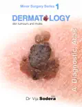 Dermatology: Skin Tumours and Moles book summary, reviews and download
