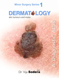 dermatology: skin tumours and moles book cover image