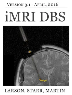 interventional mri-guided dbs book cover image