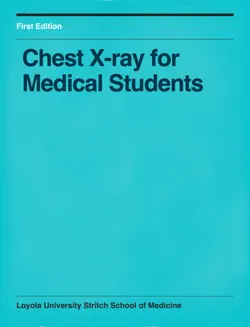 chest x-ray for medical students book cover image