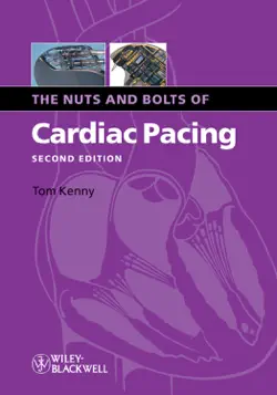 the nuts and bolts of cardiac pacing book cover image