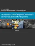 Ultrasound-Guided Regional Anesthesia: Interactive Manual for Beginners book summary, reviews and download