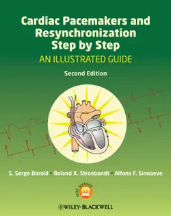 cardiac pacemakers and resynchronization step by step book cover image