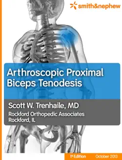 arthroscopic proximal biceps tenodesis book cover image