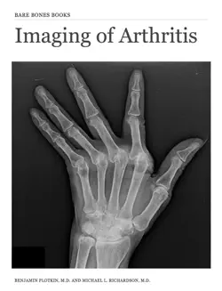 imaging of arthritis imagen de la portada del libro