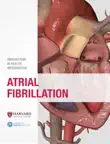 Atrial Fibrillation synopsis, comments