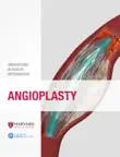 Angioplasty synopsis, comments