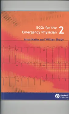 ecgs for the emergency physician 2 book cover image