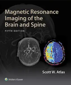 magnetic resonance imaging of the brain and spine book cover image