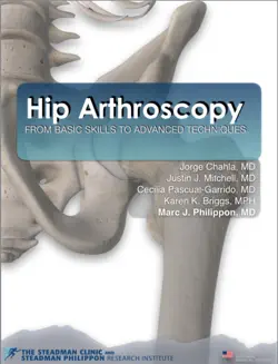 hip arthroscopy book cover image