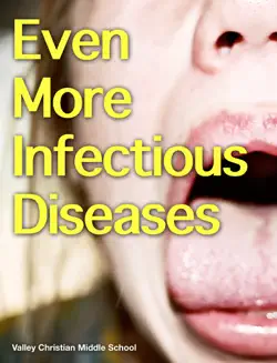 even more infectious diseases book cover image