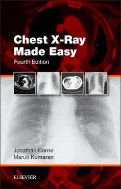 chest x-ray made easy e-book book cover image
