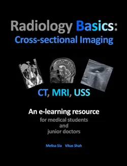 radiology basics: cross-sectional imaging book cover image