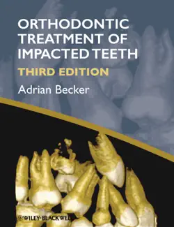 orthodontic treatment of impacted teeth book cover image