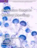 Illustrative Cases in Medical Mycology reviews