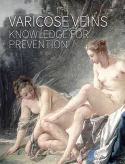 varicose veins book cover image