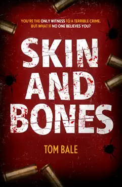 skin and bones book cover image